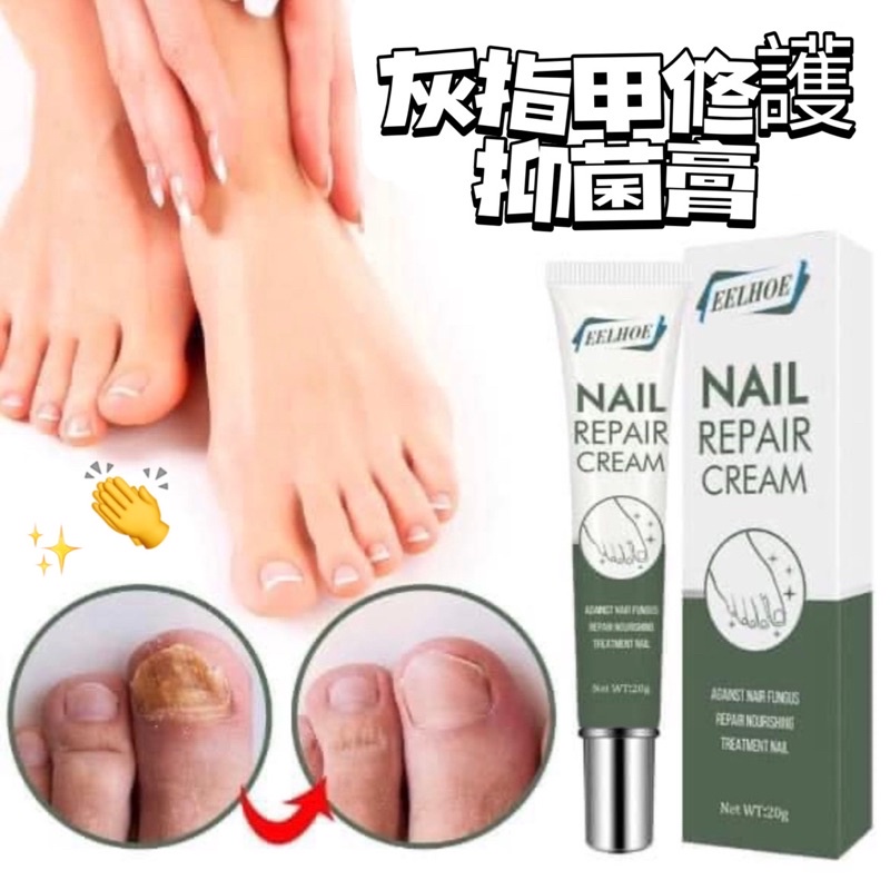 ʸᵘ ˢʰᵒᵖ 🦄 預購｜Nail Repair Cream 灰指甲護理抑菌膏