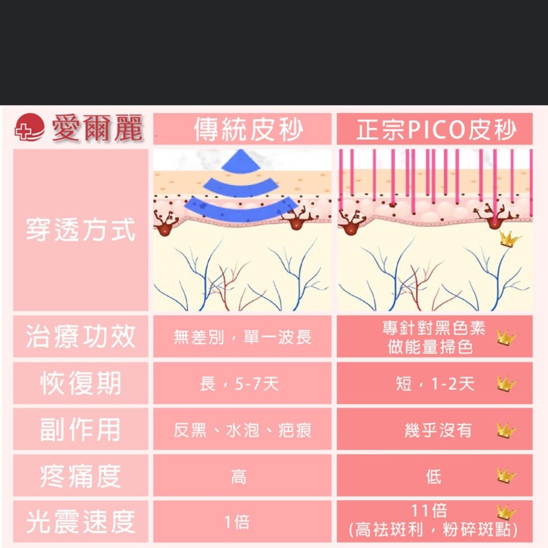 愛爾麗教你先填平這條溝 針對像hsiyi這樣的熟女案例 愛爾麗診所王修民醫師提到許多人想改善淚溝只是治標不治本 只顧填平淚溝 卻忘了隨年紀增長