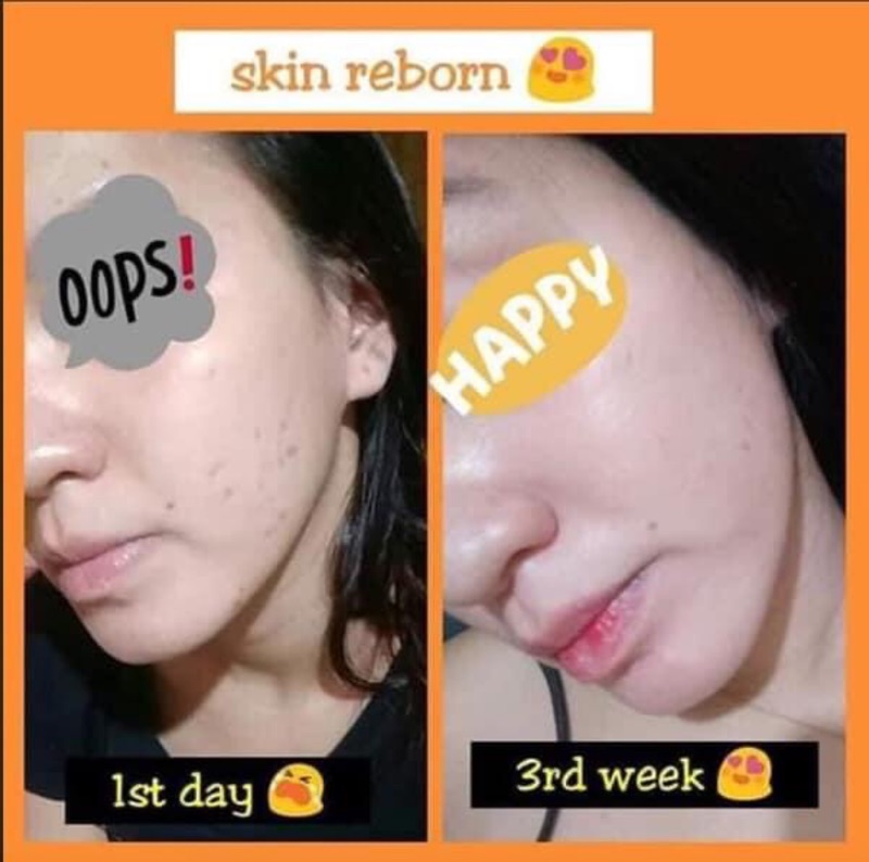 dewy skin reborn