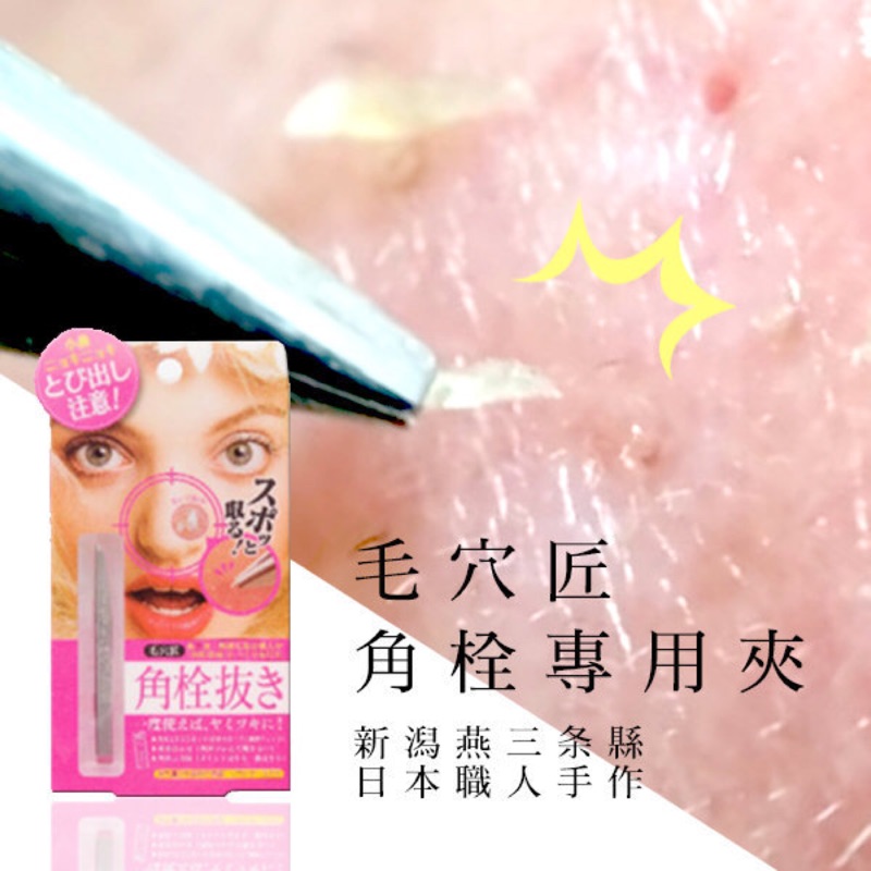 毛穴匠角栓專用夾 現貨 蝦皮購物