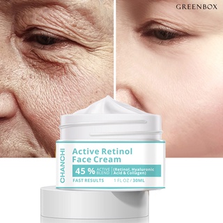 [艾美麗美甲美妝]CHANCHI 視黃醇面霜 去除皺紋抗衰老Active Retinol Face Cream 30ml