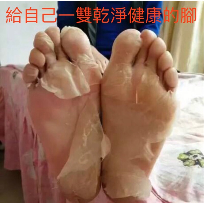 防疫免運 去腳皮止癢 強效版 狠厲害 無印工坊 天然精油醋液 厚繭 香港腳腳臭專用10 100ml 蝦皮購物