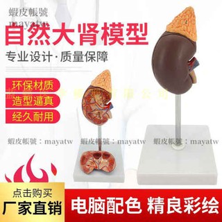 (MD-B_0717)腎臟 模型 人體 內臟模型 骨骼 自然大腎解剖附腎上腺模型標本
