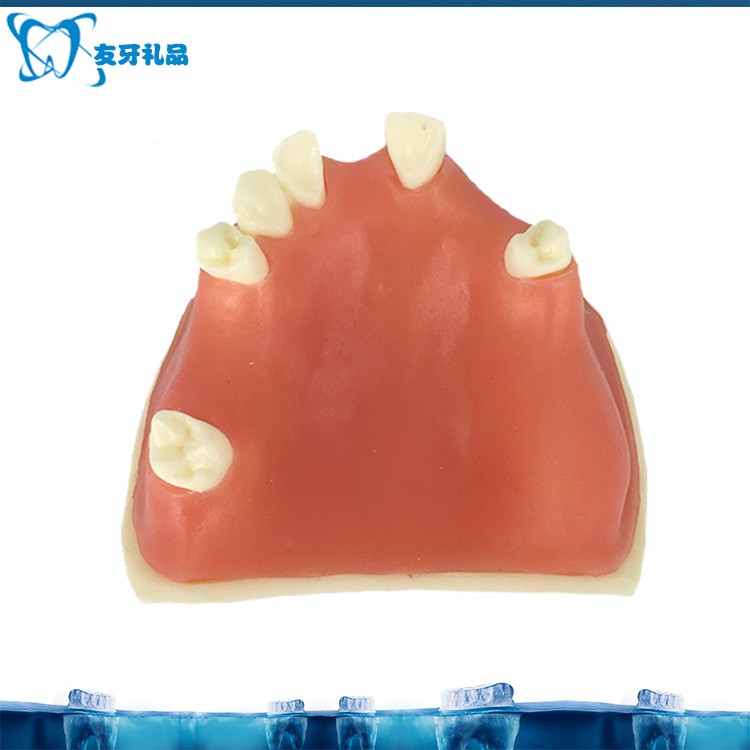 口腔種植仿真下頜練習牙齒模型軟牙齦口腔模型種植牙培訓模型