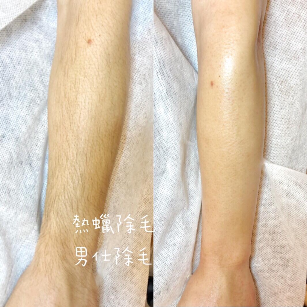 熱蠟除毛私密除毛巴西式除毛孕婦除毛陰部除毛桃園義大利進口蠟豆 蝦皮購物