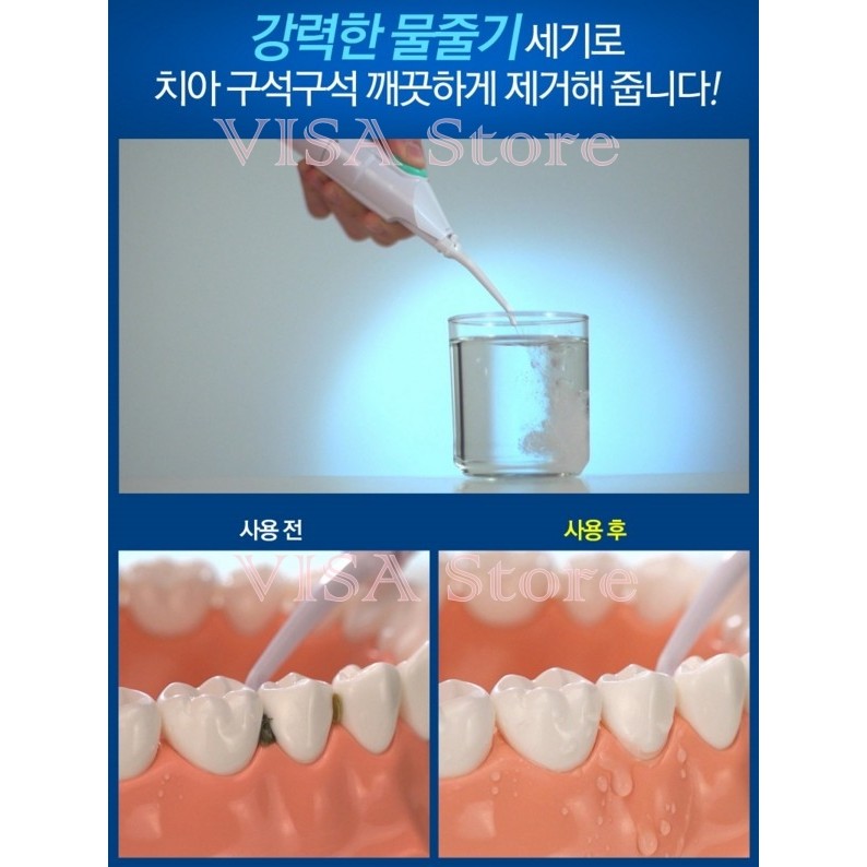 牙齒美白 沖牙機 洗牙機空氣動能 水牙線機  牙齒沖洗器 沖牙器 牙套 假牙牙齒矯正清潔必備