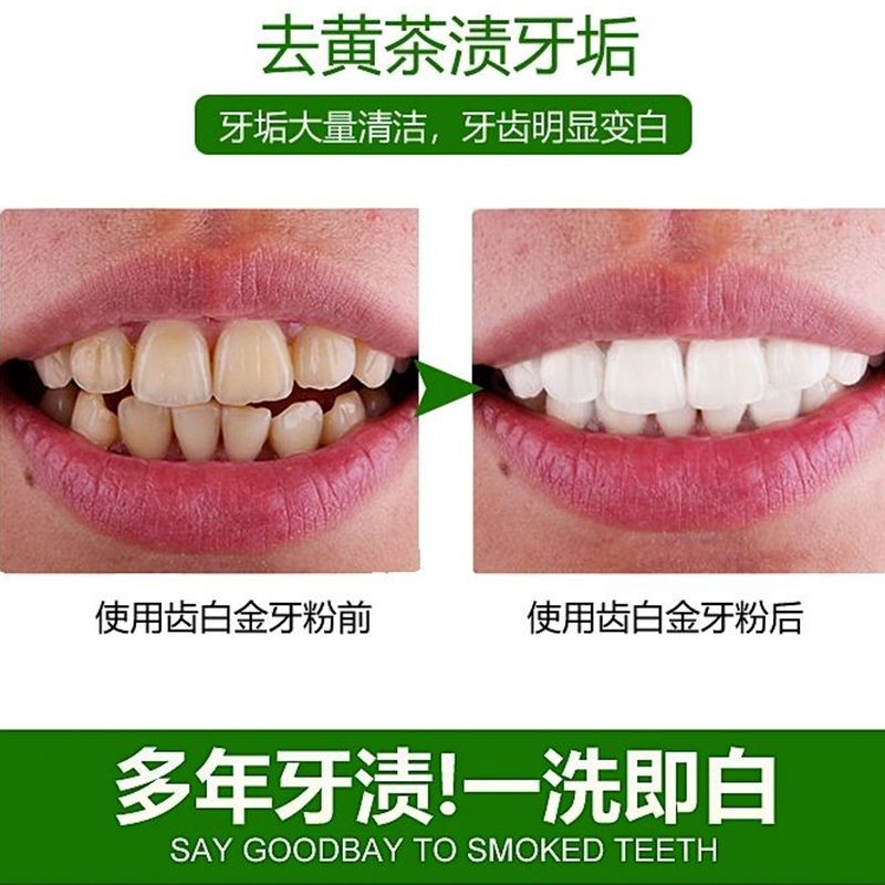 亮白牙齒美白神器 齒白金洗牙粉美白牙齒神器去黃牙去煙漬牙去牙結石去口臭廠家正品 蝦皮購物