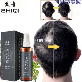 脂溢性脫髮 優惠推薦 21年1月 蝦皮購物台灣