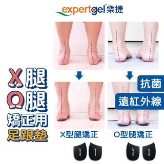 樂捷 日本 愛倍多 XO 矯正 凝膠 鞋墊 內八 外八 O型腿 X型腿 台灣製 抗菌 矽膠 矽膠 足 腳