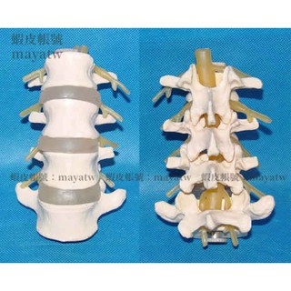 (MD-B_1473)腰椎 脊椎 大型四節腰椎模型 人骨模型 腰椎模型 4節腰椎模型