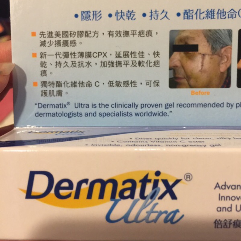 Dermatix@倍舒痕@