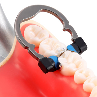 牙科截面矩陣系統套裝輪廓矩陣夾環帶楔形刀楔形塑料套件牙醫工具