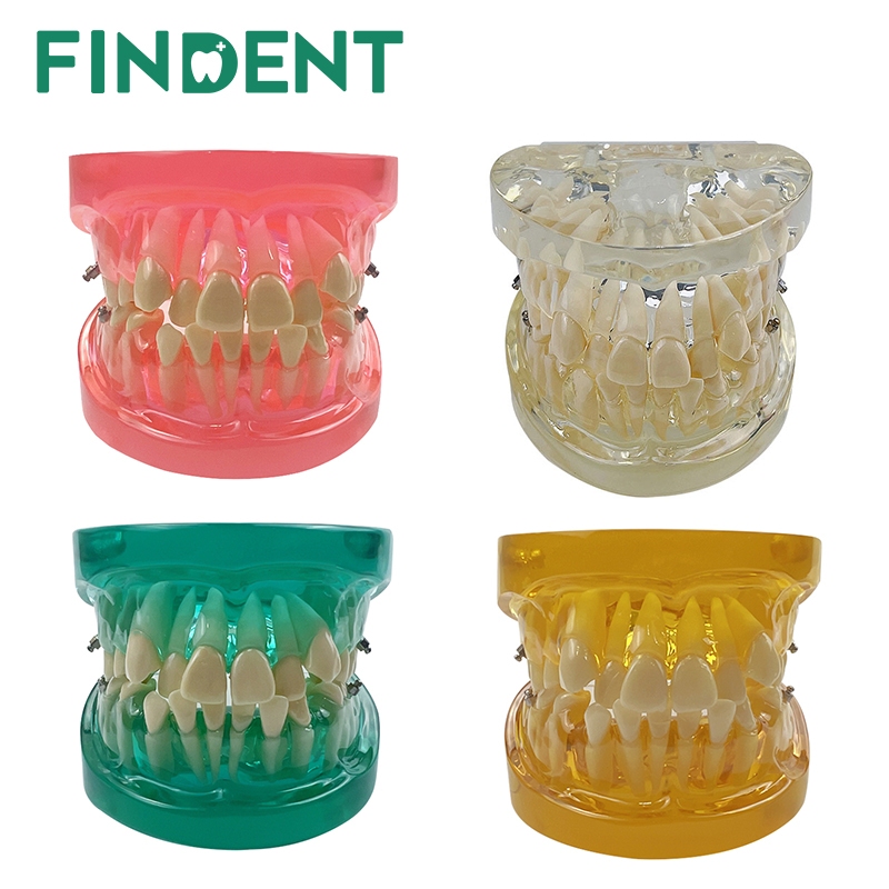 牙科模型透明牙齒咬合模型用於患者通信牙科牙醫教學研究模型