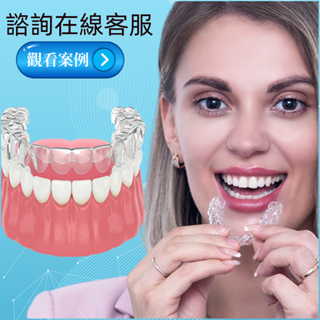 🦷美牙神器🦷牙齒矯正 牙齒矯正器 牙齒保持器 4D升級款 牙套 磨牙保持器 地包天糾正不整齊 齙牙 磨牙保護 隱形牙套