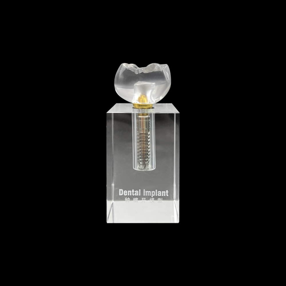 種植牙牙齒模型水晶種植牙假牙模型可拆卸typodont結構教學學習練習訓練