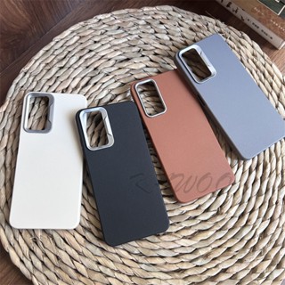 Redmi 10 Note 10 10 10s 11 11s 12 Pro 4G 皮革皮膚超薄柔軟 TPU 相機環可拆卸