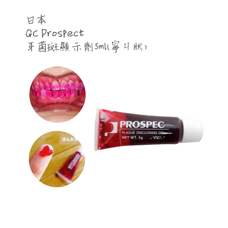 🔥送塗抹棒🔥★日本進口★GC Prospec牙菌斑顯示劑(凝膠狀) 5g