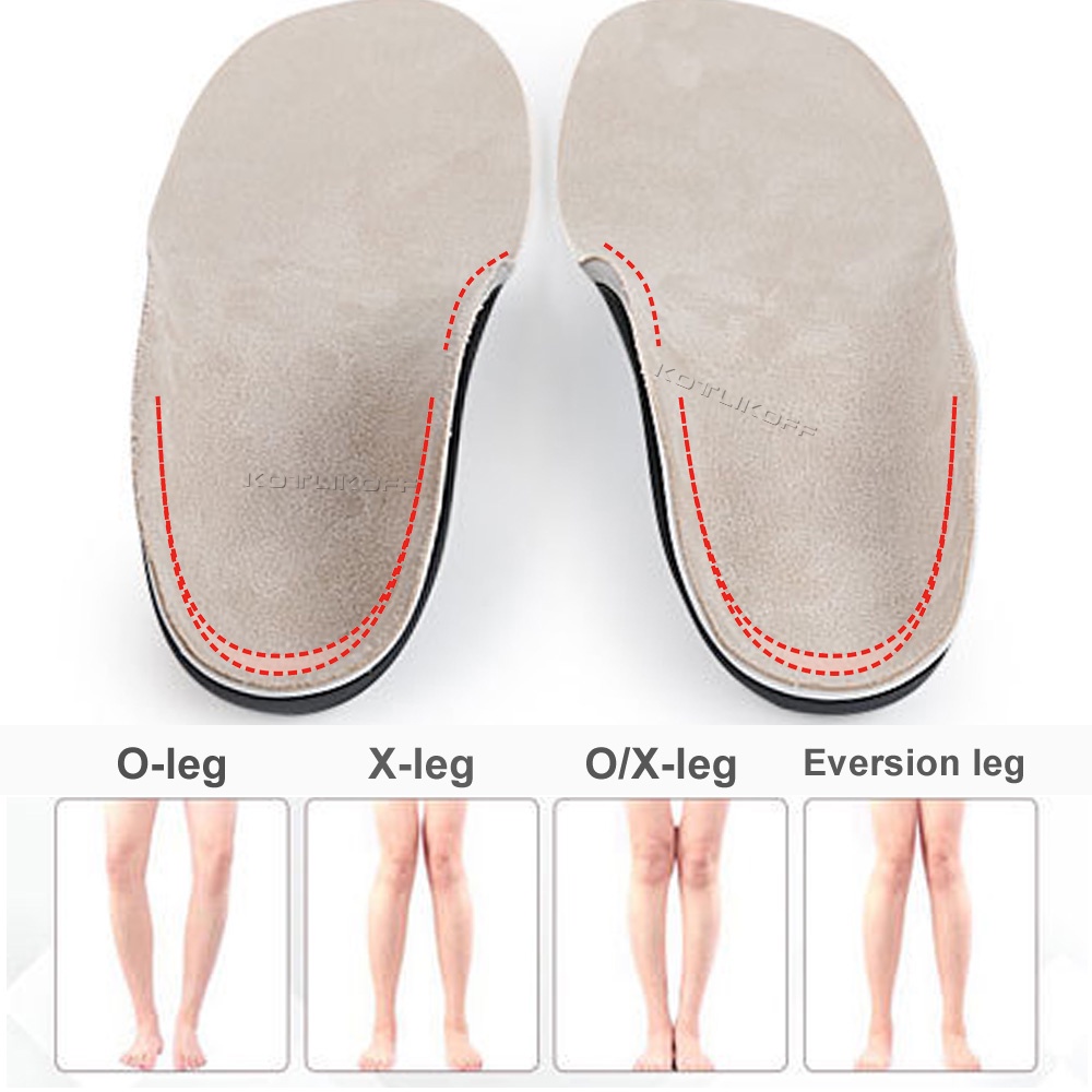 兒童兒童矯形鞋墊足弓支撐扁平足鞋墊插入 O/X 型腿內翻矯形墊足部矯正器