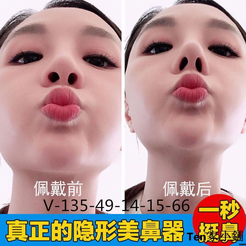 韓國挺鼻神器 Ptt Dcard討論與高評價網拍商品 2021年11月 飛比價格