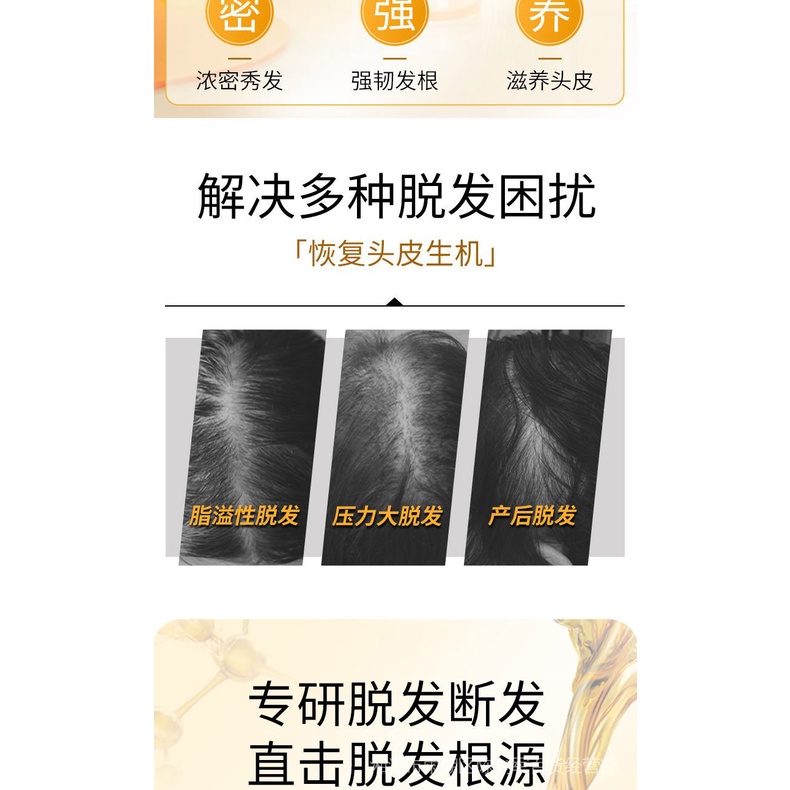 優惠裝修正姜約防脫洗髮露草本固發養髮增發強韌髮根濃密秀髮滋養頭皮 蝦皮購物