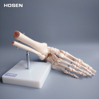 【上發】腳踝關節模型 足踝模型 腳骨模型 足部模型 醫學模型 人體模型 教學 研究 展示 腳掌模型 腳部骨骼 構造 結構