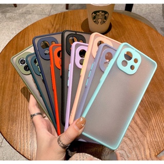 小米 MI Xiaomi 11 小米11 Lite 11Lite Mi11 5G NE Xiaomi11 輕巧 手機殼