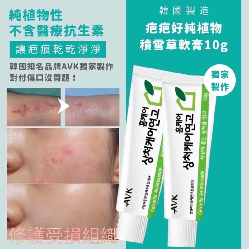 積雪草軟膏在拍賣的價格推薦 22年3月 比價比個夠biggo