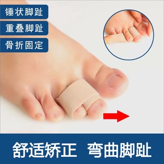 腳趾骨折 比價撿便宜 優惠與推薦 22年3月