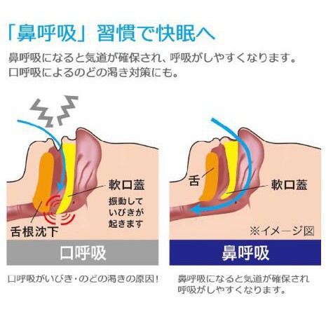 舌根 沈下 原因 舌根沈下 ぜつこんちんか の原因と影響 Amp Petmd Com