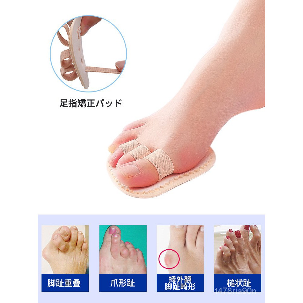 腳趾矯正器重疊趾 Ptt討論與高評價商品 21年8月 飛比價格