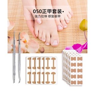 正甲工具套裝 一次解決您腳趾凍甲的煩惱 免膠水矯正嵌甲 無痛矯正嵌甲貼 彈力護甲貼 嵌甲貼 甲溝炎 捲甲 預防凍甲