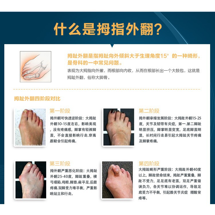 特惠特惠低價看得見 分趾器韓國進口凝膠拇指外翻矯正器成人足大腳骨腳趾分趾器可穿鞋日夜用