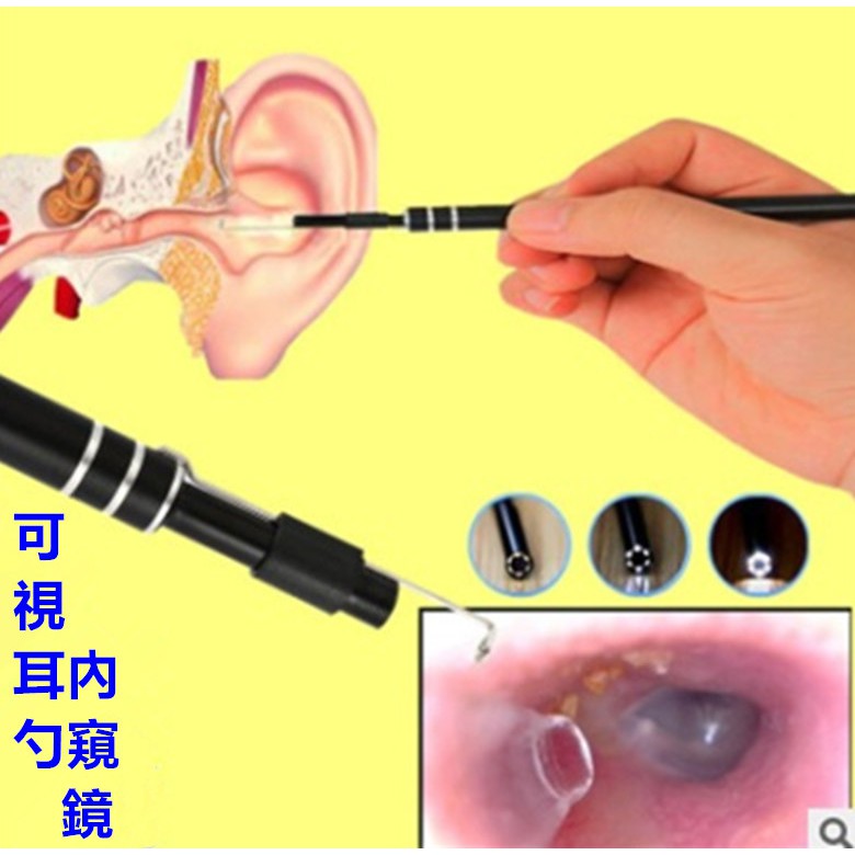 挖耳棒 掏耳棒 超高清可視發光耳勺 掏耳神器 鏡頭式挖耳棒 三合一版挖耳勺神器 潔耳器 放大高清窺視鏡 耳鼻喉牙科內窺鏡