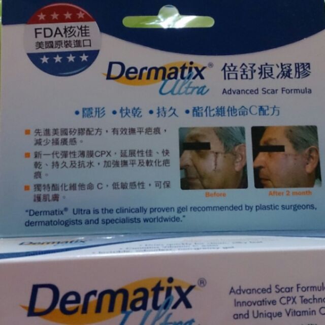 Dermatix倍舒痕凝膠