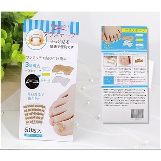 凍甲矯正 免膠水正甲貼 嵌甲貼 腳趾甲 甲溝炎 捲甲 腳趾甲貼片 預防凍甲 美甲腳趾 肉包甲糾正 糾正指甲矯正