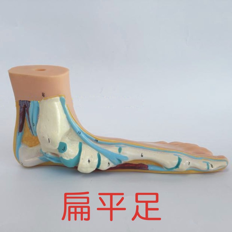 可開發票 扁平足 1:1腳模型解剖模型 腳部構結構 造肌肉血管 腳模型 教學模型ARCV客滿來