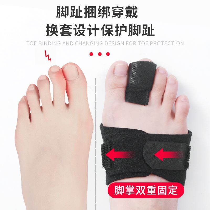 手指固定器 Ptt Dcard討論與高評價網拍商品 21年9月 飛比價格