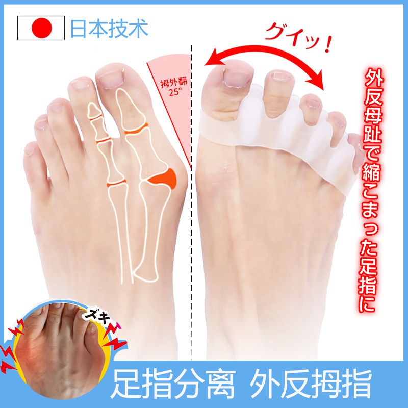 日本腳趾矯正器五指硅膠分離器拇指外翻矯正器大腳骨糾正器 蝦皮購物