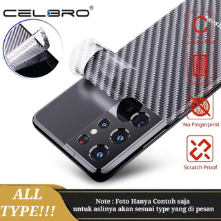 華為 Nova 2i 3i 3e Nova 5T Nova 7 7 SE Nova 9 Nova 10 皮膚碳防刮後蓋