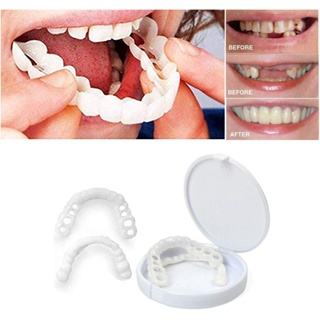 2Pcs/Set Comfort Fit Flex White Fake Teeth Cover Top Veneer