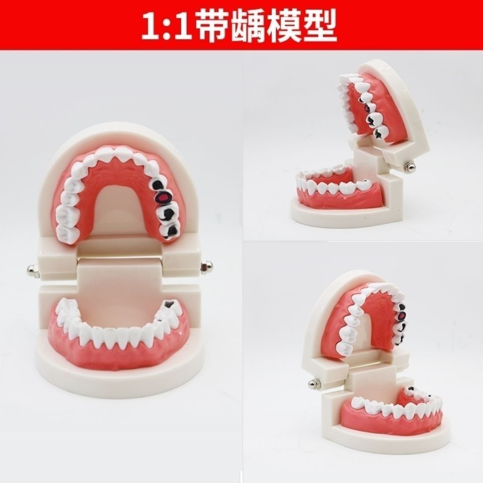 補牙神器牙科標準牙模型 牙齒模型牙模教學假牙幼兒園刷牙練習 口腔模型