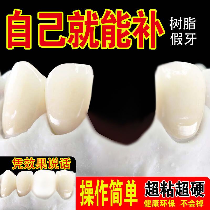 補牙神器臨時假牙補牙材料自制假牙材料牙縫仿真牙美觀遮蓋樹脂牙齒
