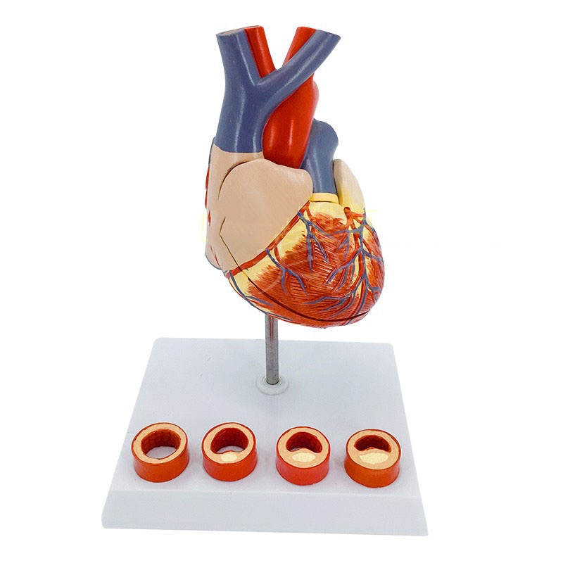 1:1心臟模型 自然大心臟帶4階段血管解剖膜型 人體解剖心臟 教學模型 心血管內科 教學示範