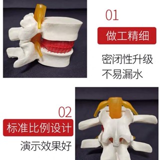 質量保證 教學模型 臺灣熱銷腰椎放大 腰椎間盤/突出演示模型 人體脊柱 脊椎骨病理演示模型