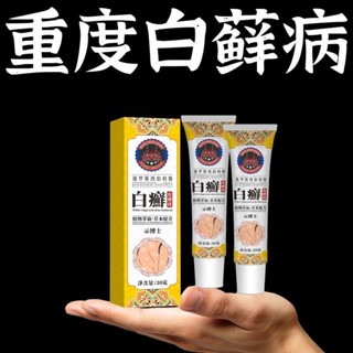 皮膚泛白色塊草本乳膏身體膏皮膚白塊皮膚全身外用無痕磨砂乳膏-5.24