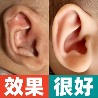 耳朵矯正器嬰兒新生的兒矽膠耳撐垂耳招風耳耳夾耳廓糾正定型神器/6.10