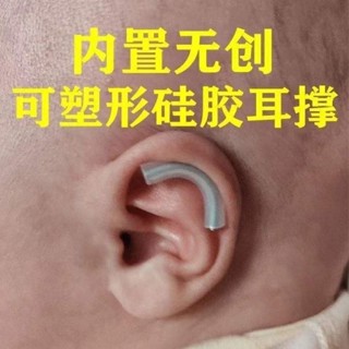 內建無創嬰兒耳朵矯正器耳廓矯形貼新生兒畸形耳型垂耳糾正定型器[HG]