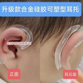 矽膠嬰兒耳朵矯正器耳廓矯形新生兒畸形耳型垂耳糾正定型神器膠捲