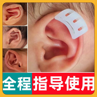 新生兒耳朵矯正器嬰兒寶寶兒童耳廓塑形大人耳夾貼面耳定型矽膠貼//6.7