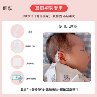 矽膠嬰兒耳朵矯正器矽膠矯形新生兒畸形塑形耳型垂耳糾正定型神器Silicone baby ear corrector fo